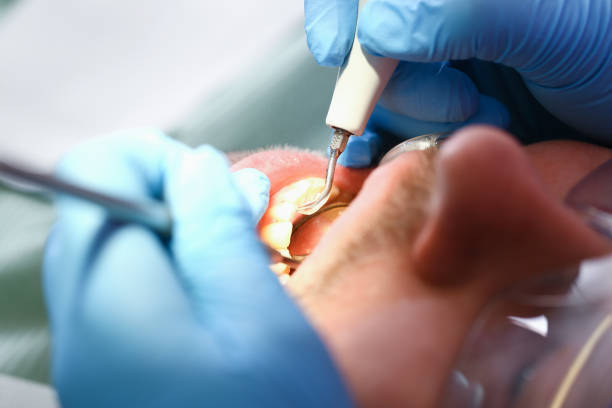 Best Emergency Treatment for Toothache in Centerton, AR