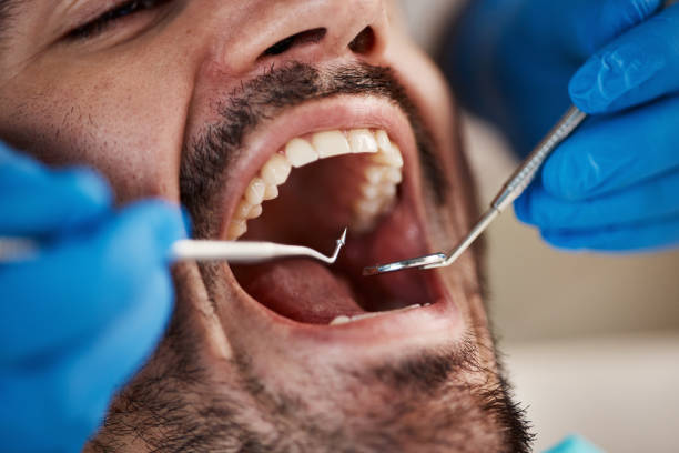 Best Same-Day Emergency Dentist in Centerton, AR