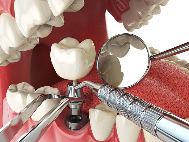Best Walk-In Emergency Dentist in Centerton, AR